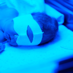 geelzucht baby